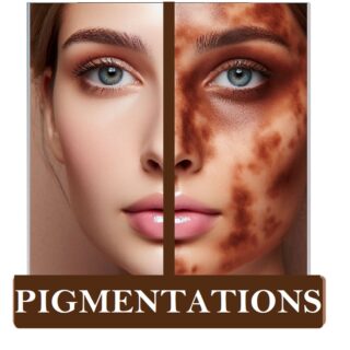 Pigmentation Product Set. (How to remove pigmentation at home naturally.)